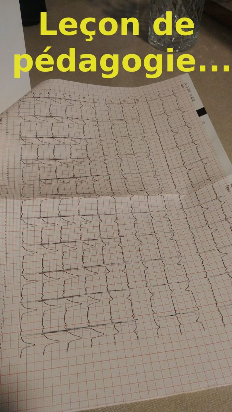 Gwendall Lecomte –  Electrocardiogramme et formation